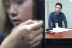 Kẻ sàm sỡ nữ sinh trong thang máy chỉ bị phạt 200 nghìn đồng, cô gái thốt lên: "Rất buồn và bất bình"