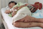 Khởi tố, bắt tạm giam kẻ nhốt, đánh thai phụ 18 tuổi đến sẩy thai