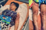 Những kẻ giam cầm, tra tấn cô gái đến sẩy thai ở TP.HCM sẽ bị xử lý thế nào?