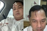 Người bị "nhóm cảnh sát bị vây nhốt" đánh may 13 mũi yêu cầu khởi tố vụ án