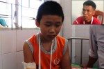 Bắt nghi phạm đánh gãy tay bé 13 tuổi bán vé số, cướp 1,2 triệu đồng