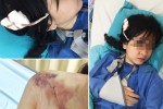 Thiếu nữ bị ôtô va chạm, máu đầm đìa: Tài xế vô cảm chạy luôn giữa Sài Gòn