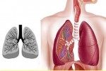 43% ca tử vong do bệnh lý hô hấp liên quan đến ô nhiễm không khí