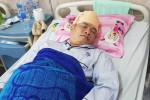 Bị đánh xuất huyết não vì vay tín dụng đen ở Sài Gòn