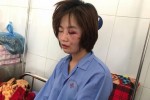 Xác định nhóm côn đồ hành hung nữ phụ xe buýt trong ngày 20/10