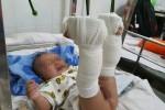 Con 4 tháng nghi bị cha đánh gãy chân, yêu cầu kiểm tra ma túy với mẹ