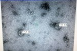 Việt Nam nuôi cấy và phân lập thành công virus corona mới