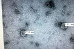 Việt Nam nuôi cấy và phân lập thành công virus corona: Điều đó có ý nghĩa như thế nào?