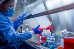 Phát hiện mới về loại vaccine lâu đời ngừa bệnh lao có thể chống SARS-CoV-2
