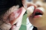 Phụ huynh tố giáo viên chủ nhiệm tát chảy máu mồm học sinh vì làm toán sai