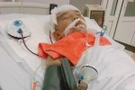 Tai nạn thương tâm tại nhà: Trẻ bị que sắt cắm vào đầu, bị chó cắn vào mặt