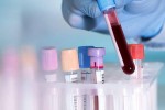 Việt Nam sẽ sớm tự sản xuất test kit chủ lực và phù hợp để phòng chống COVID-19