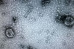 Bệnh nhân ở Đà Nẵng mang chủng virus chưa từng xuất hiện tại Việt Nam