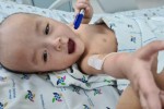 Trúc Nhi - Diệu Nhi sắp được tập đi sau ca mổ tách rời